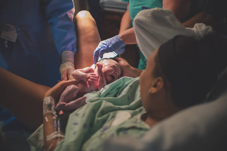 Why you need a birth photographer for your c-section